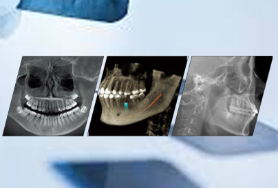 Radiologie diadent